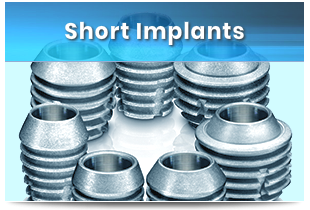 Short Implantat