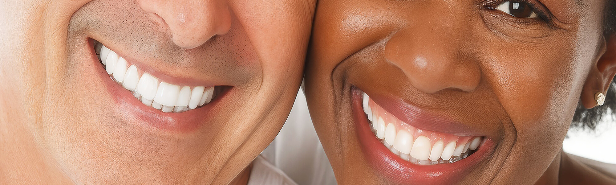 Zwei lächelnde Münder aus der Nähe; sichtbare weiße Zähne und Lippen.