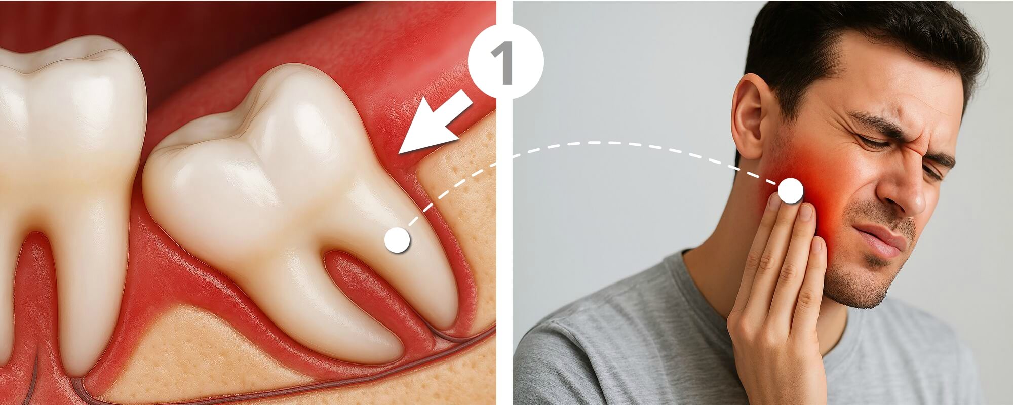 Links eine Ansicht und Lage des Weisheitszahnes, rechts ein Mann mit Zahnschmerzen die sich die Wange festhält