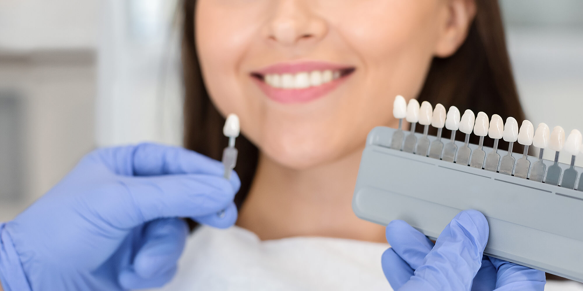 Zahnfarbskala vor dem Lächeln einer Patientin; behandschuhte Hände vergleichen die Zahnfarbe für Veneers, Krone oder Zahnaufhellung.