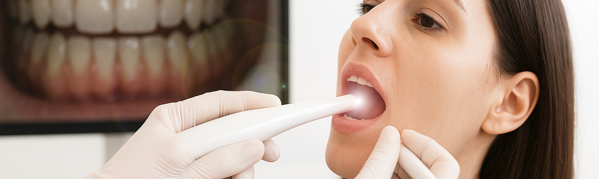 Zahnärztliche Untersuchung mit intraoraler Kamera; Patientin öffnet den Mund, Kamera erzeugt Lichtpunkt, im Hintergrund vergrößerte Zahnaufnahme auf Monitor.