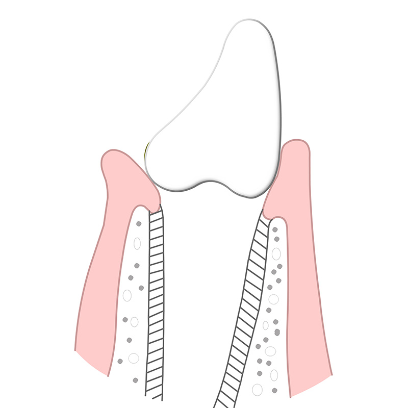 Das Bild zeigt im Querschnitt einen gesunden Zahn.